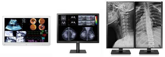 ▲왼쪽부터 LG전자 수술용 모니터(32HL714S), 진단용 모니터(31HN713D), 임상용 모니터(27HJ713C) / 사진=LG전자